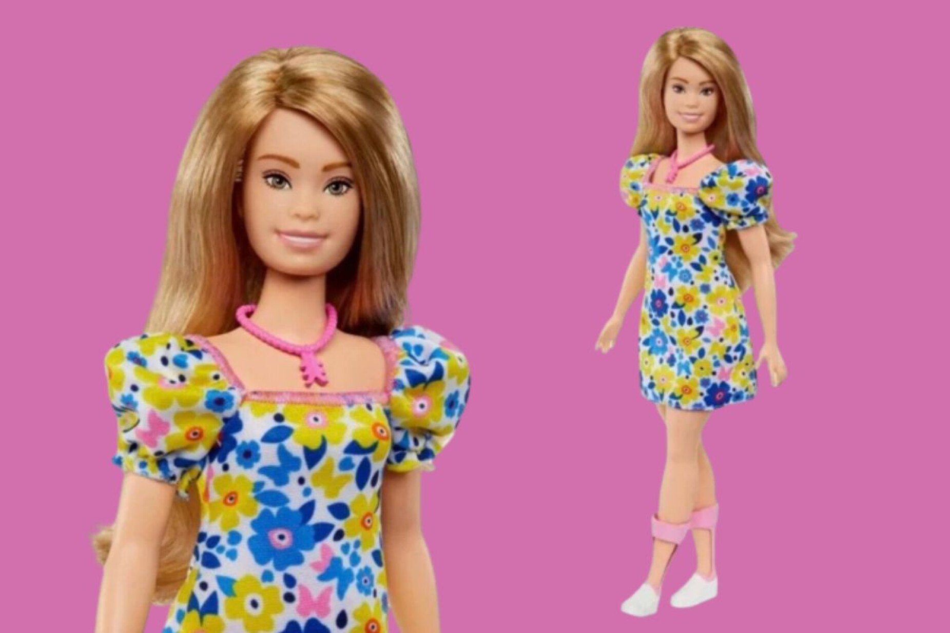 Barbie com síndrome de Down, cadeira de rodas e vitiligo: os